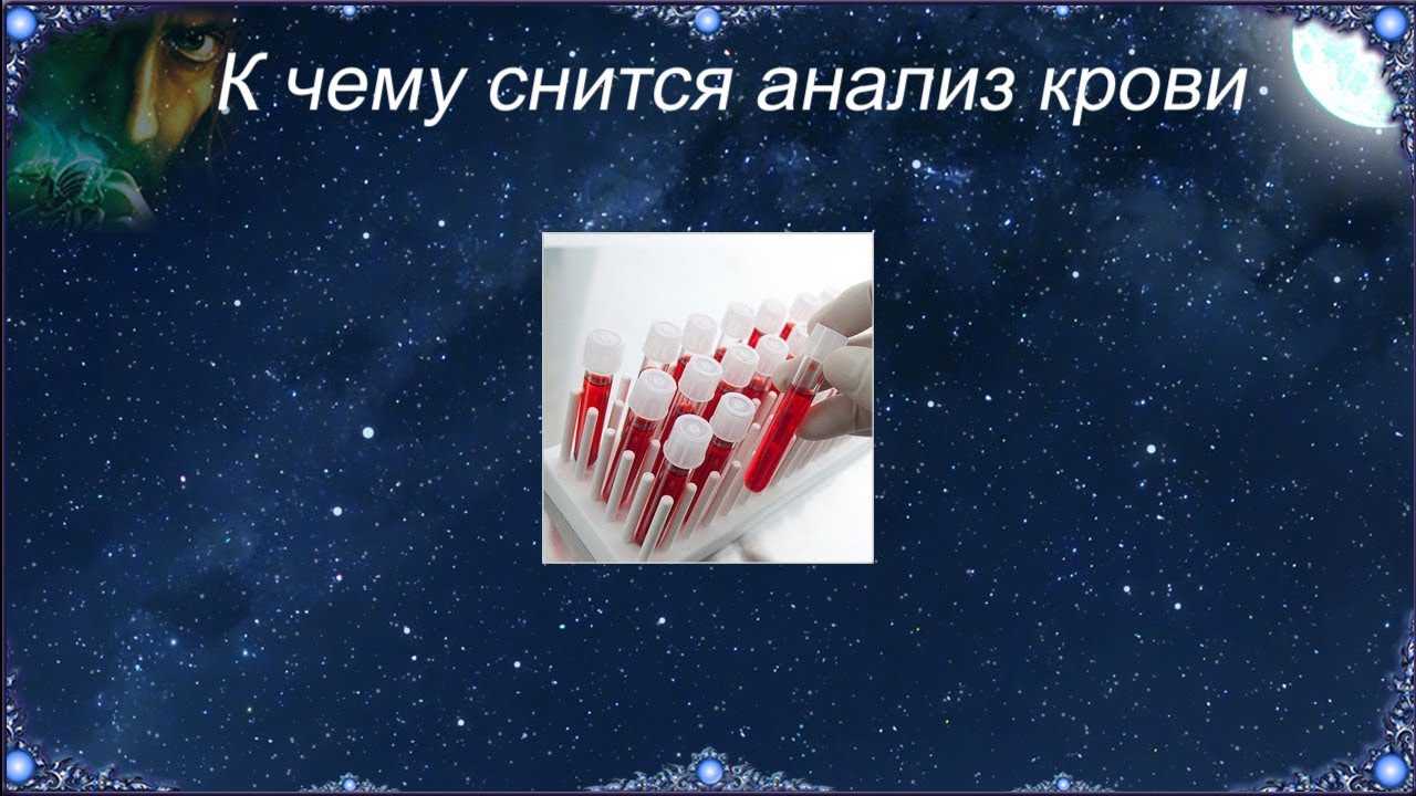 «менструация к чему снится во сне? если видишь во сне менструация, что значит?»
