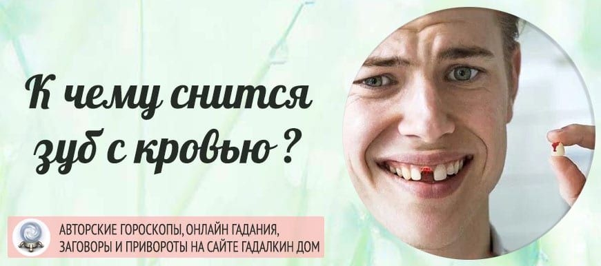 К чему снится выпадение зуба с кровью? толкование по 28 сонникам
