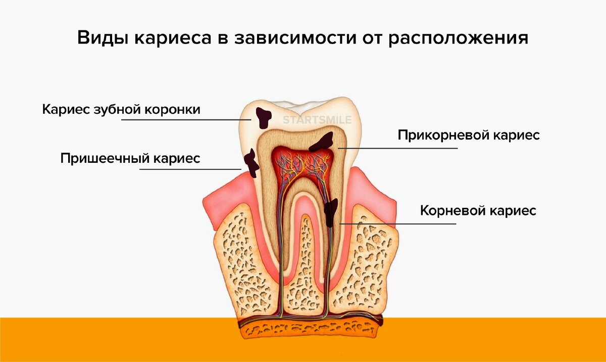 Зубы и карма: зеркало истории рода