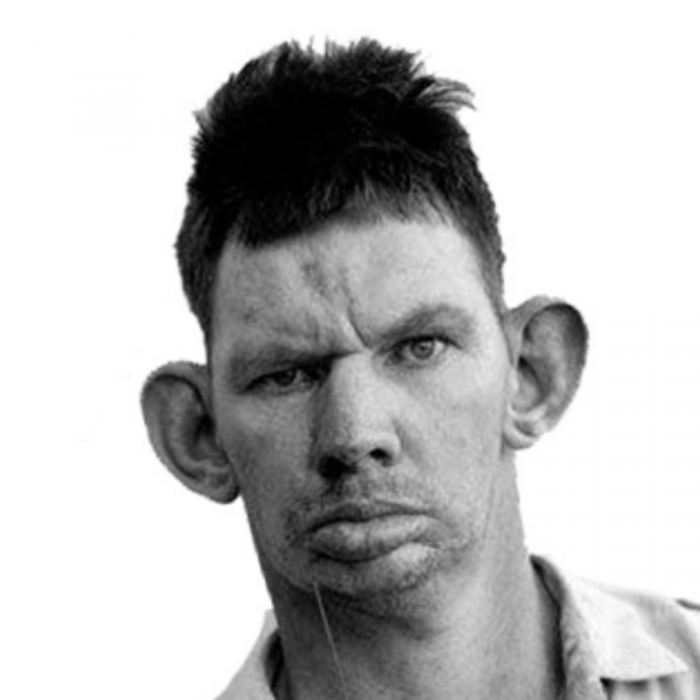 Болезни которые превратили в шутки абоба