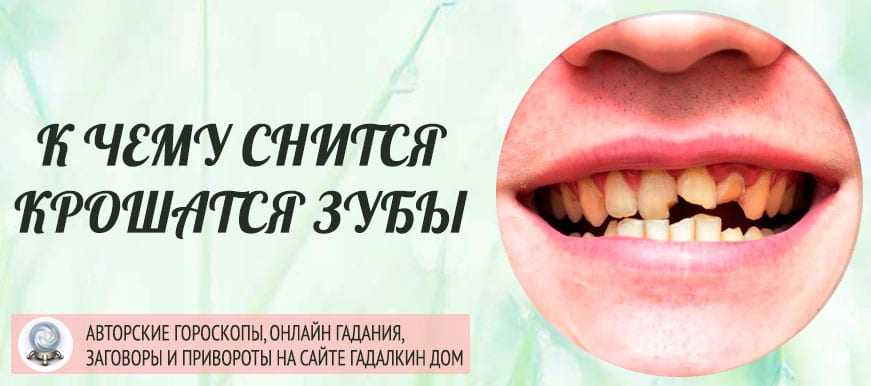 К чему снятся выпавшие и больные зубы, здоровые и белые, вставные челюсти во сне